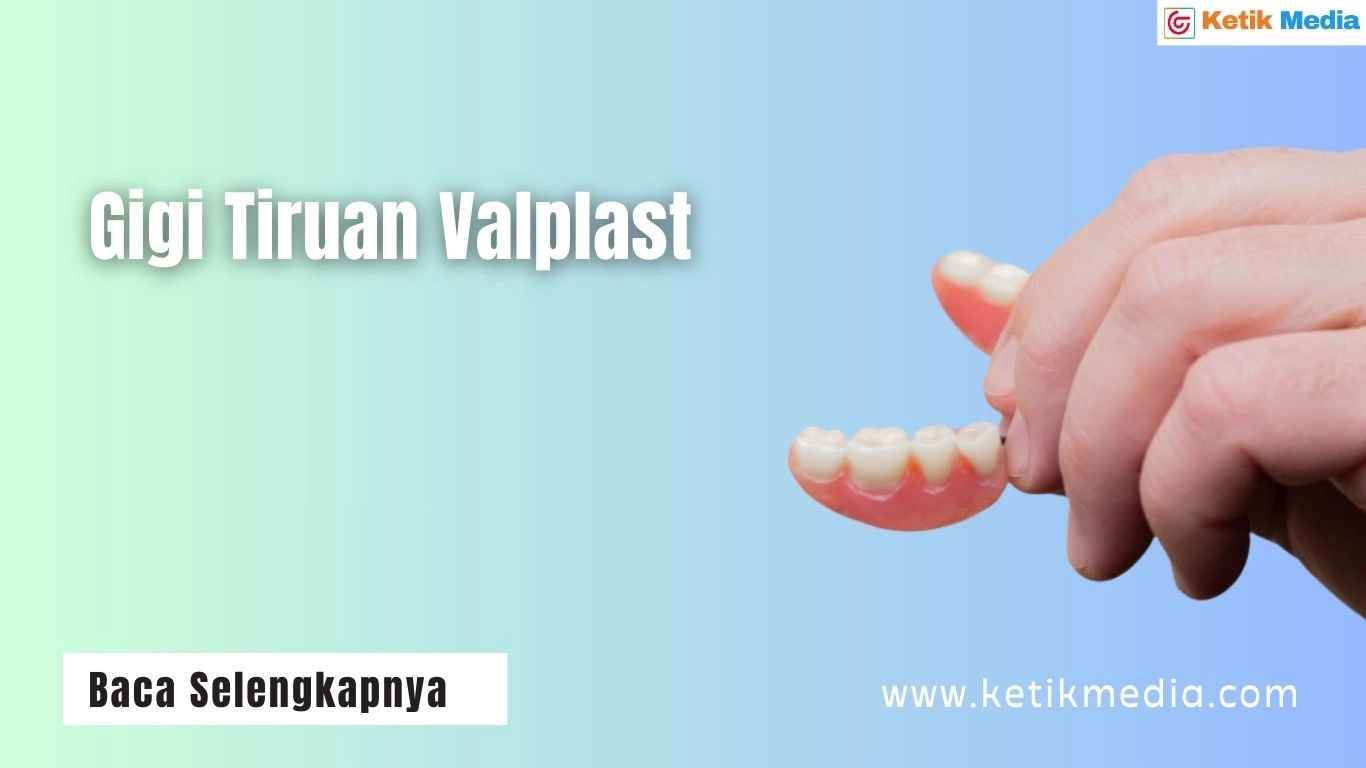 Gigi Tiruan Valplast