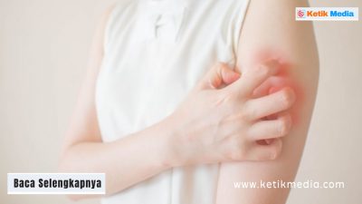alergi obat