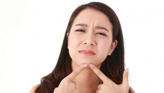 Penyebab Jerawat di Wajah dan Punggung Beserta Pengobatannya
