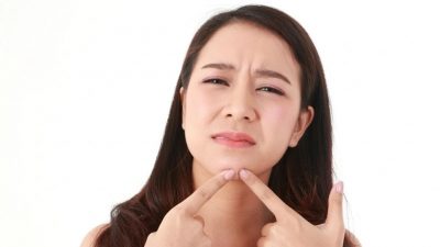 Penyebab Jerawat di Wajah dan Punggung Beserta Pengobatannya