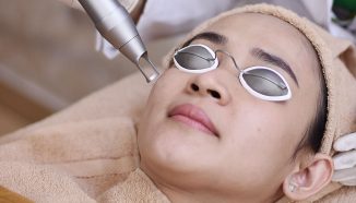 5 Terbaik Treatment Untuk Flek Hitam yang Pasti Tokcer