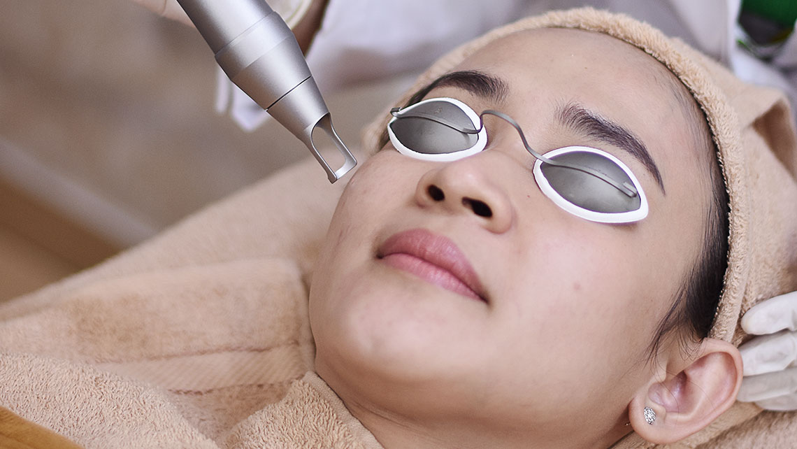 Treatment Untuk Flek Hitam