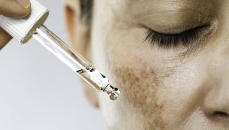 Treatment Flek Hitam: Pengertian dan Fungsinya