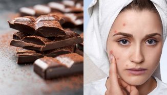 Apakah Konsumsi Coklat Efektif Mengatasi Jerawat? Ini Jawabannya