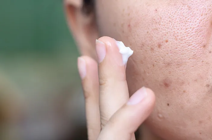 flek hitam di hidung
