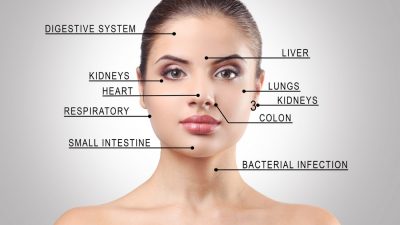 letak jerawat dan penyebabnya