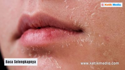 Penyakit Kulit Kering: Penyebab, Gejala dan Cara Mengatasinya