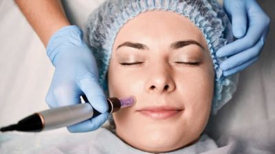 Collagen Induction Therapy