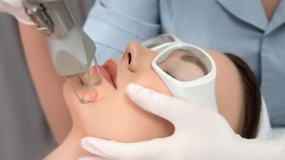Fractional Laser