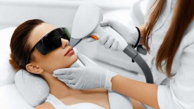 Treatment Laser Wajah