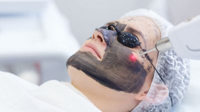 Treatment Laser Wajah 