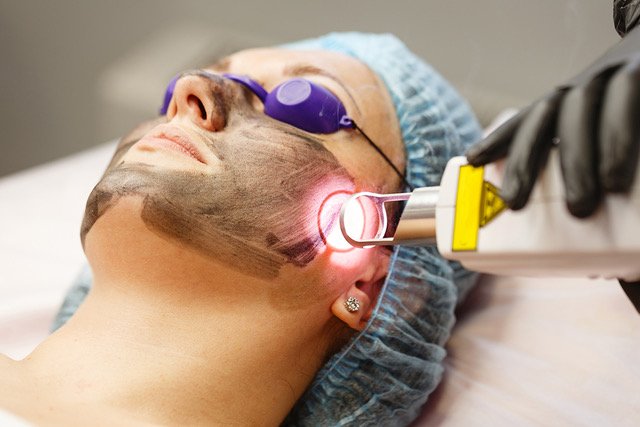Treatment Mengecilkan Pori Pori Wajah