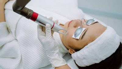 Treatment Mengecilkan Pori Pori Wajah