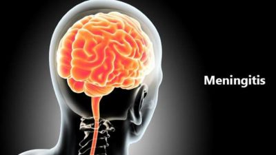 bahaya meningitis