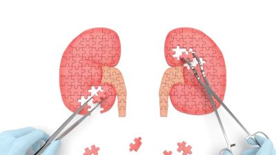 Penyebab Ginjal Bocor dan Langkah Terbaik Mencegahnya