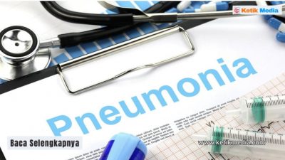 7 Indikasi Perbedaan Bronkopneumonia dan Pneumonia