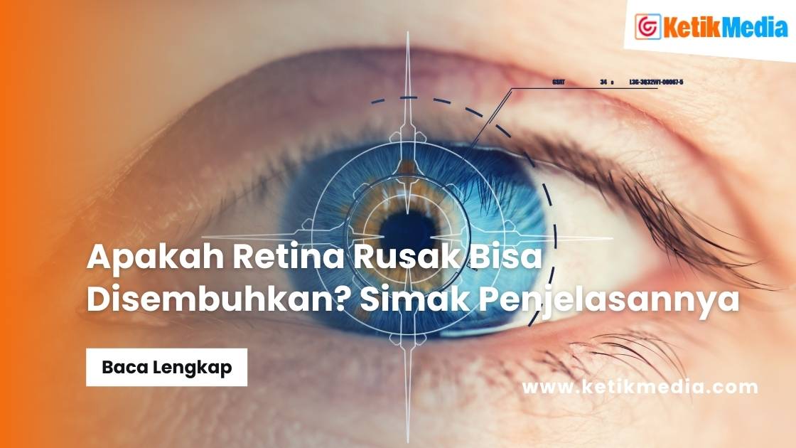 Apakah Retina Rusak Bisa Disembuhkan