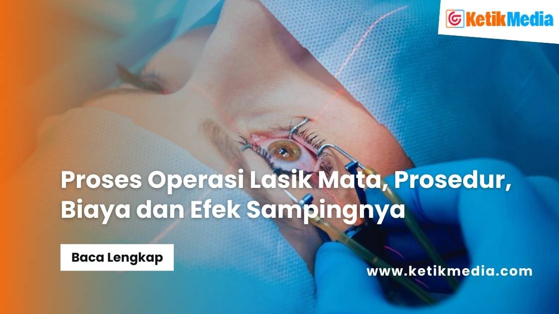 Proses Operasi Lasik Mata