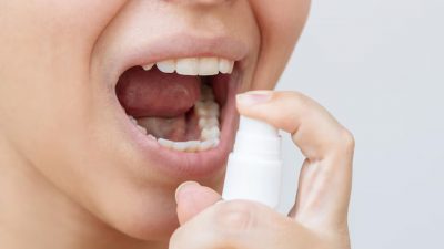 Obat Jamur Mulut di Apotik