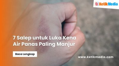 7 Salep untuk Luka Kena Air Panas Paling Manjur