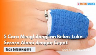 5 Cara Menghilangkan Bekas Luka Secara Alami & Cepat Sembuh