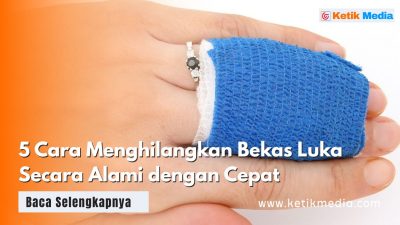 5 Cara Menghilangkan Bekas Luka Secara Alami dengan Cepat